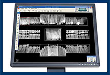 Digital Dental X-rays East Windsor NJ