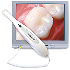 Intra-Oral Camera East Windsor NJ