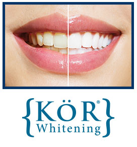 Teeth Whitening Dentist East Windsor NJ