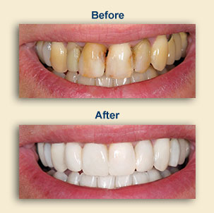 Cosmetic Dentistry East Windsor NJ