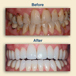 Cosmetic Dentistry East Windsor NJ