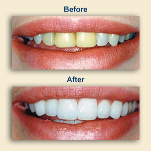 Cosmetic Dentistry East Windsor NJ